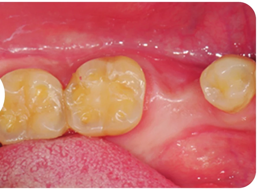 Case 1 · After