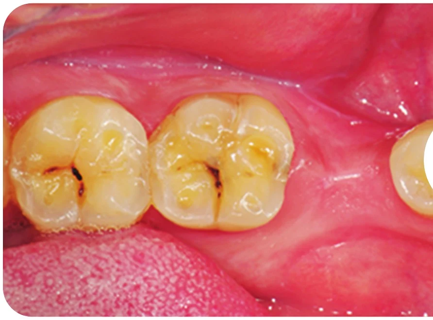 Case 1 · Before