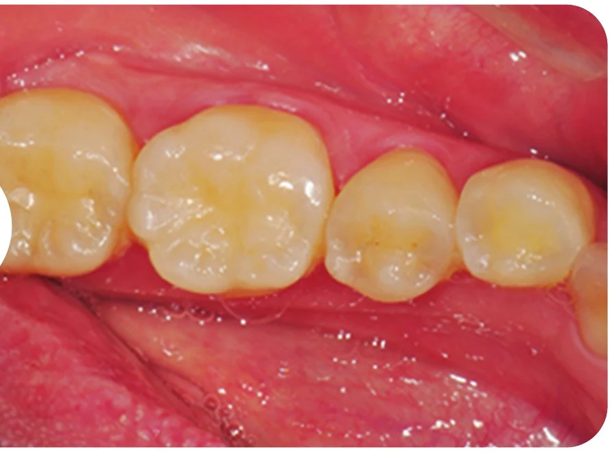 Case 2 · After