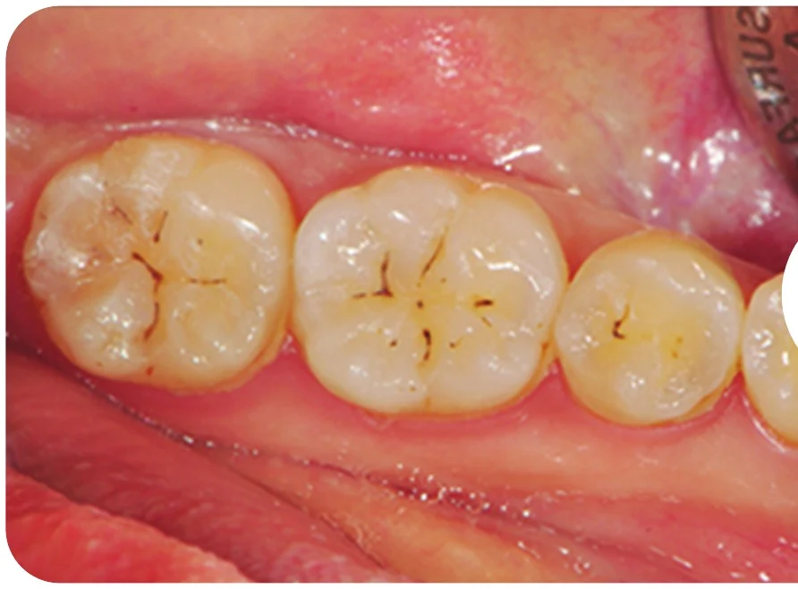 Case 2 · Before