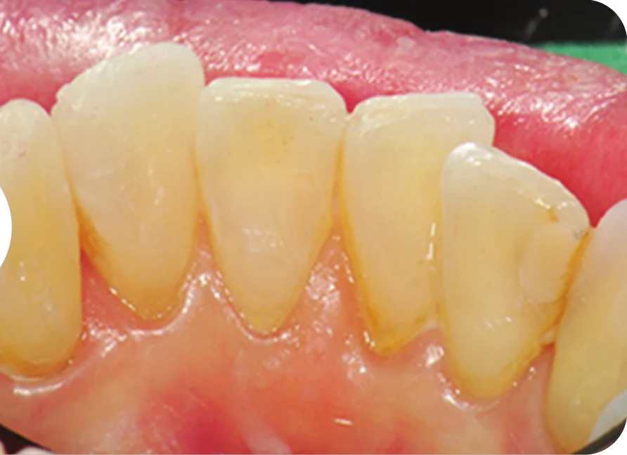 Case 1 · After