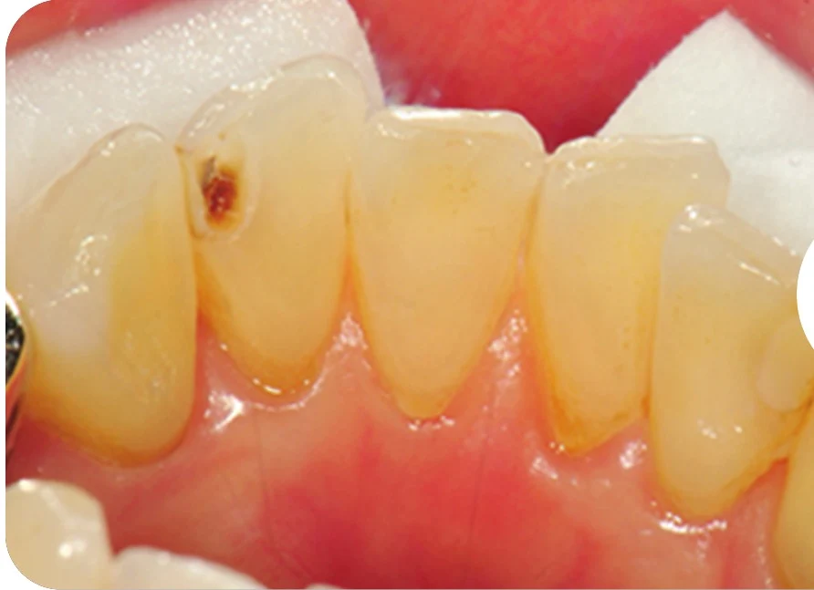 Case 1 · Before