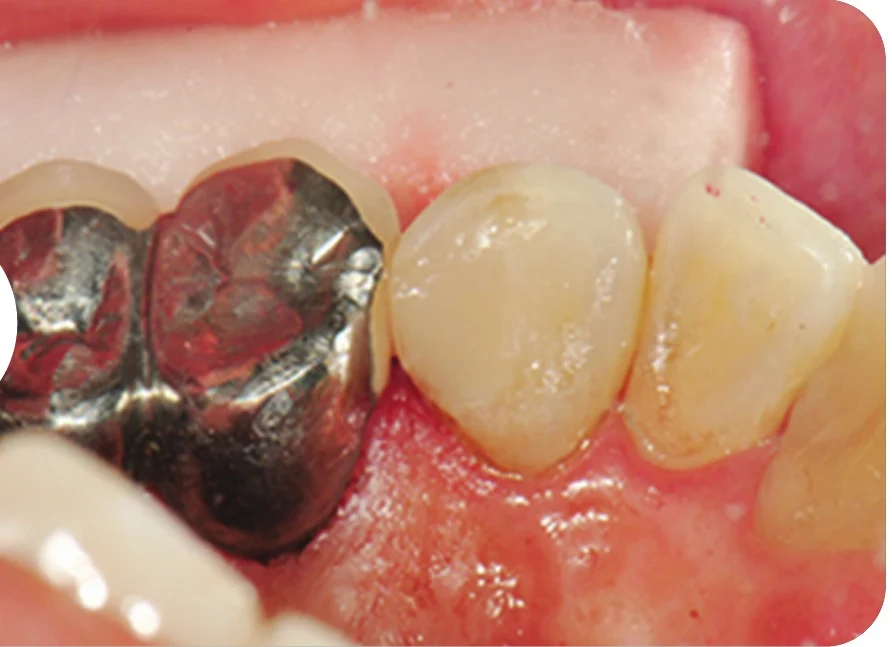 Case 2 · After