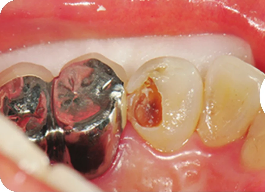 Case 2 · Before