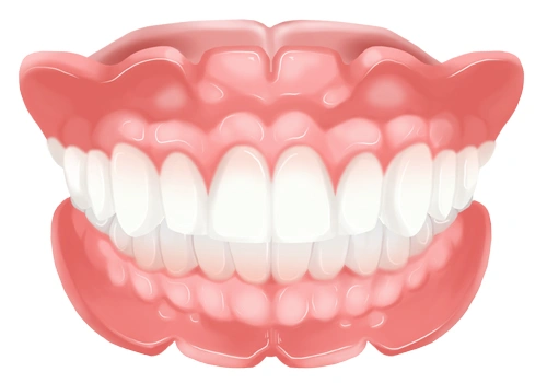 Conventional denture