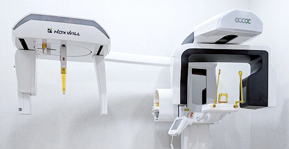 3D intraoral scanning and a digital implant system