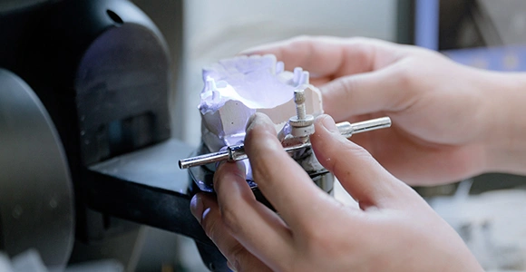 An in-house laboratory that makes the restoration the same day