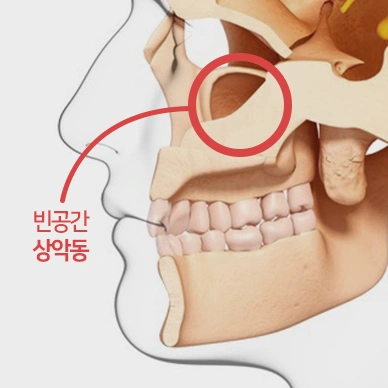 상악동(코 옆 빈 공간)의 위치