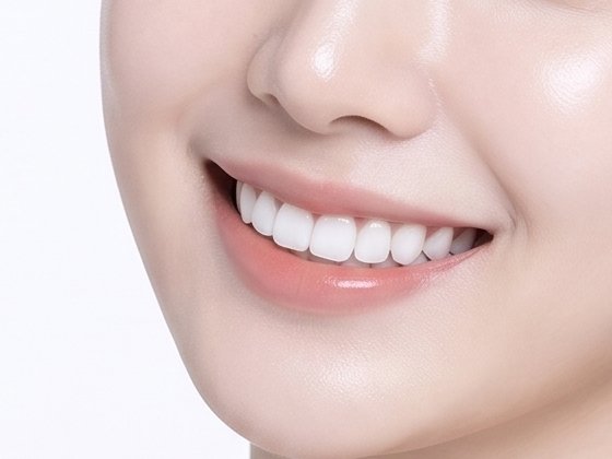 리본네이트 자연스러운 미소 클로즈업